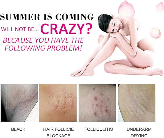 Aichun Beauty Whitening Cream For Sensitive Areas